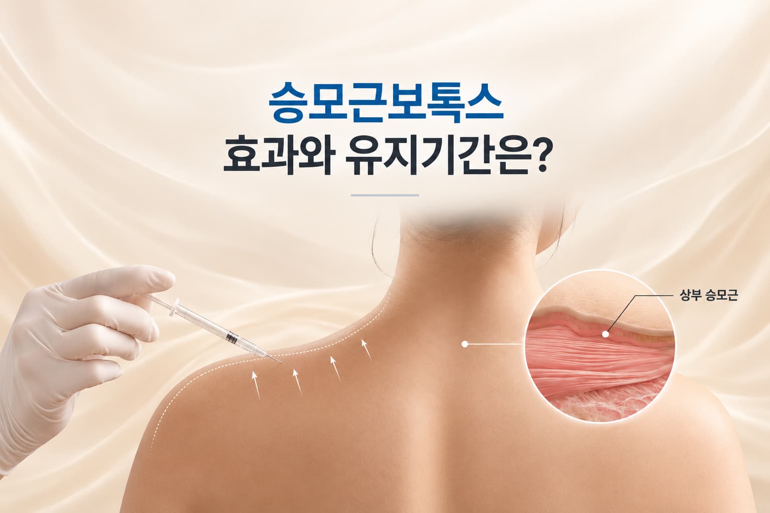 승모근보톡스 효과 언제부터 나타날까_시점별 변화와 유지기간