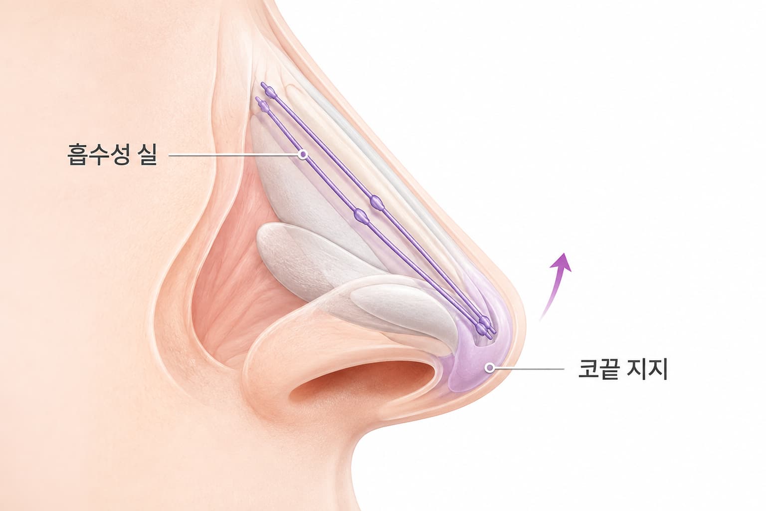 하이코 시술, 코필러와 무엇이 다를까 효과부터 유지기간까지_유앤아이의원 대전