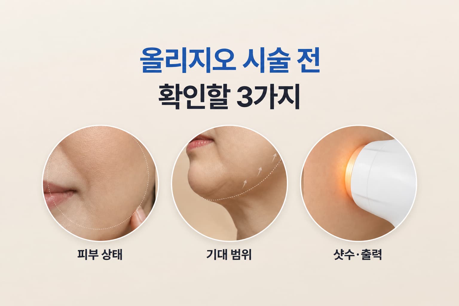 올리지오 효과 없음이 걱정된다면_시술 전 확인해야 할 3가지