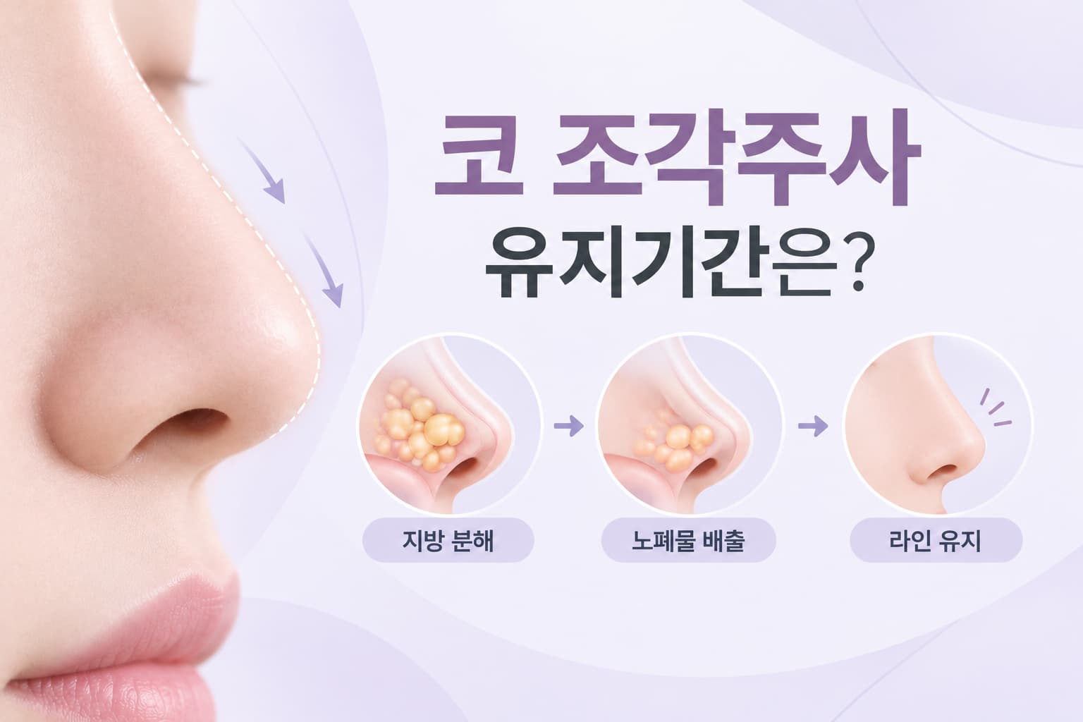 코 조각주사 유지 기간 정리 - 지방 분해 림프 배출