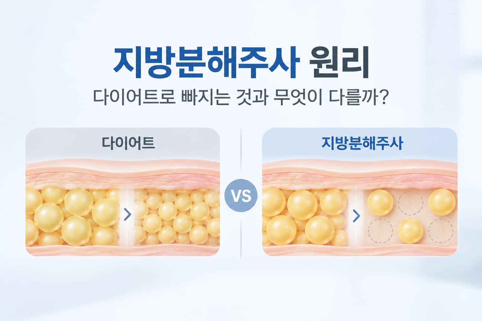 지방분해주사 원리 정리 - 지방세포 크기와 개수의 차이
