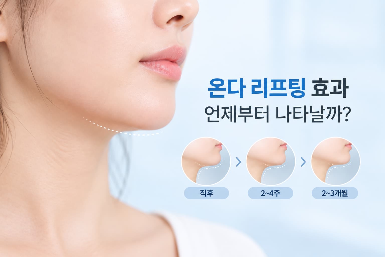 온다 리프팅 효과가 나타나는 시점별 변화 및 권장 회차와 유지 기간 안내 썸네일