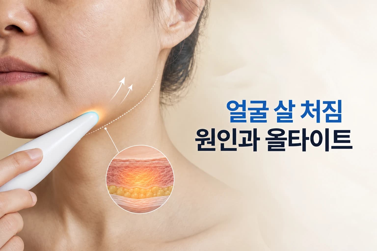 얼굴 살 처짐_올타이트로 개선할 수 있을까_원인과 부위별 활용법