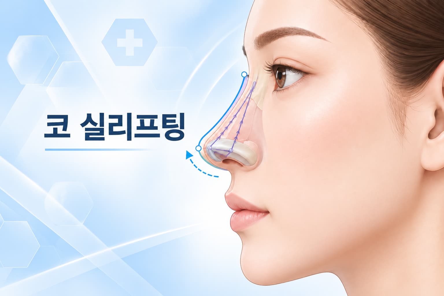 코 실리프팅, 어떤 경우에 적합할까? 코끝 변화 범위와 유지기간