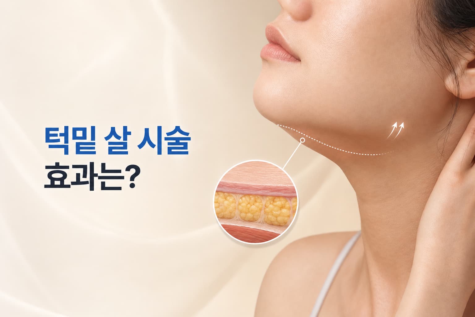 턱밑 살 시술 효과 있을까_이중턱 원인별 시술 방법 알아보기
